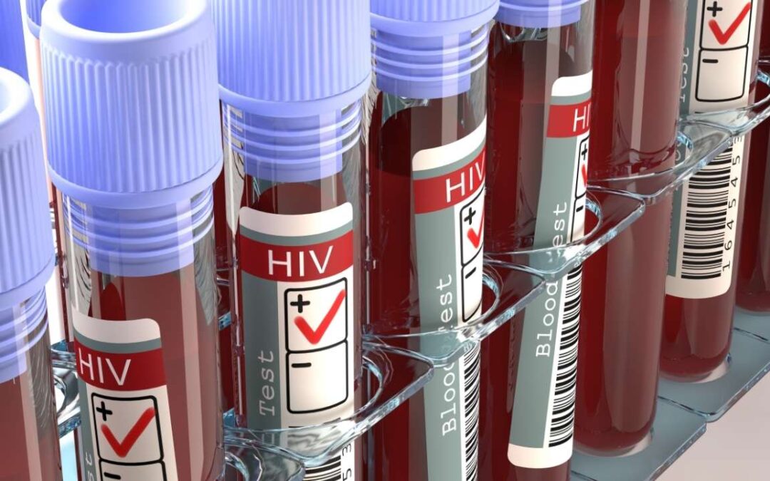 Pessoa com HIV que não manifesta os sintomas da SIDA/AIDS é isenta de IRPF