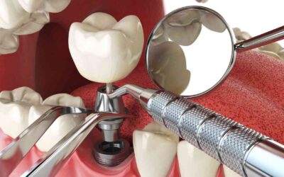 Laboratório de Prótese Dentária é Indústria para fins de IPI