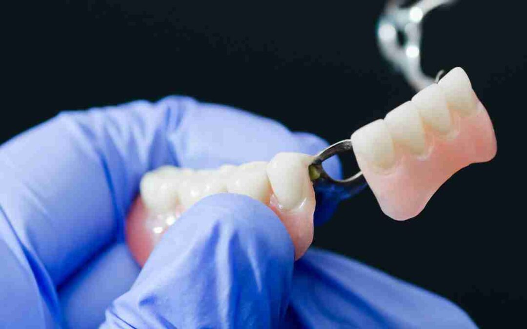 Emissão de NFS-e para Próteses Sob Encomenda